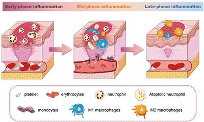 Mechanisms and applications of adipose-derived stem cell-extracellular vesicles in the inflammation of wound healing